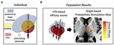 Modeling the volume of tissue activated in deep brain stimulation and its clinical influence: a review